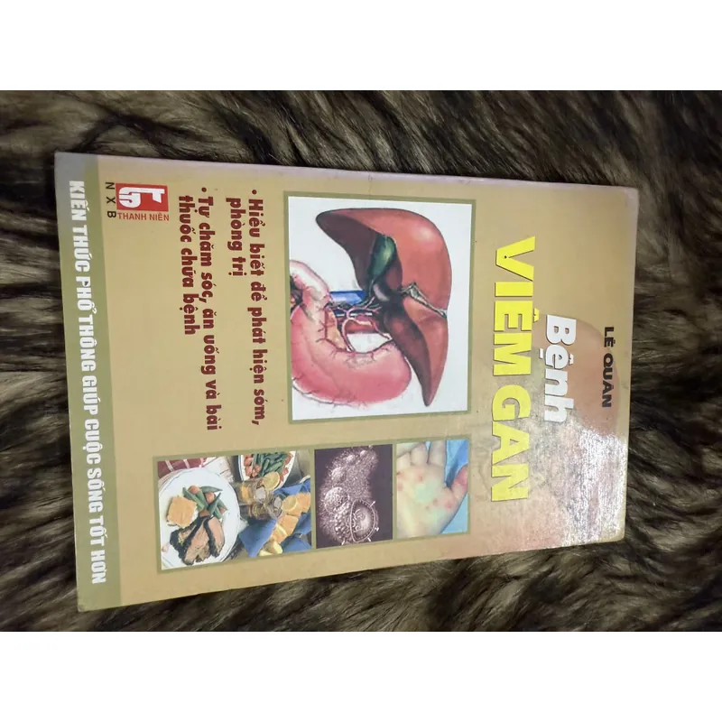 Bệnh Viêm Gan  600854