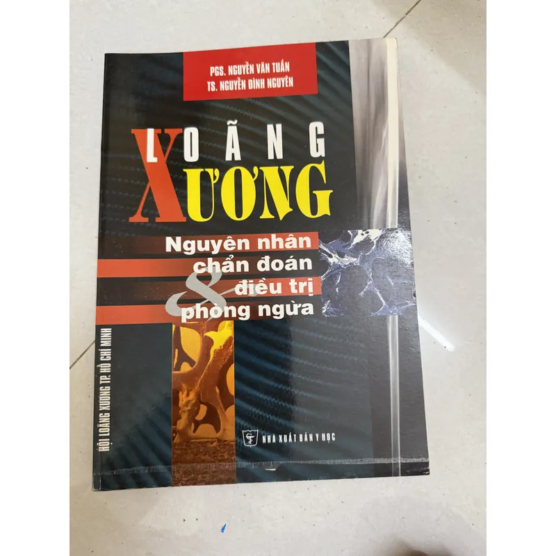 Loãng xương nguyên nhân chuẩn đoán  593711