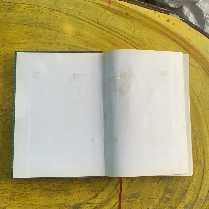 ATLAS MÔ BỆNH HỌC CÁC BỆNH CẦU THẬN & BỆNH ỐNG - KẼ THẬN 1009009