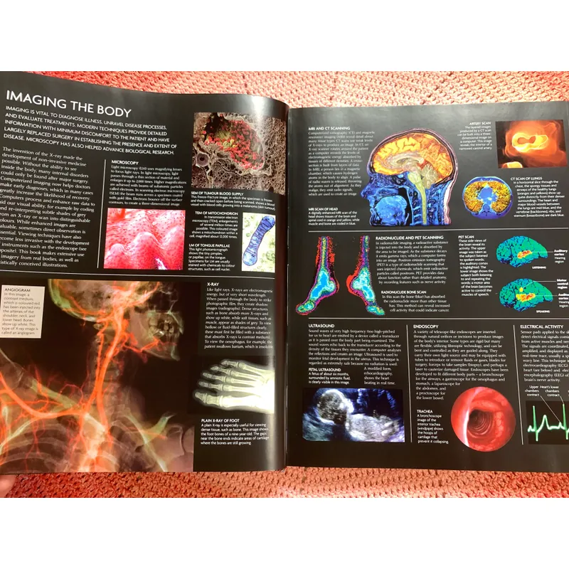 The Human Body Book: An Illustrated Guide to Its Structure, Function and Disorders. 646342