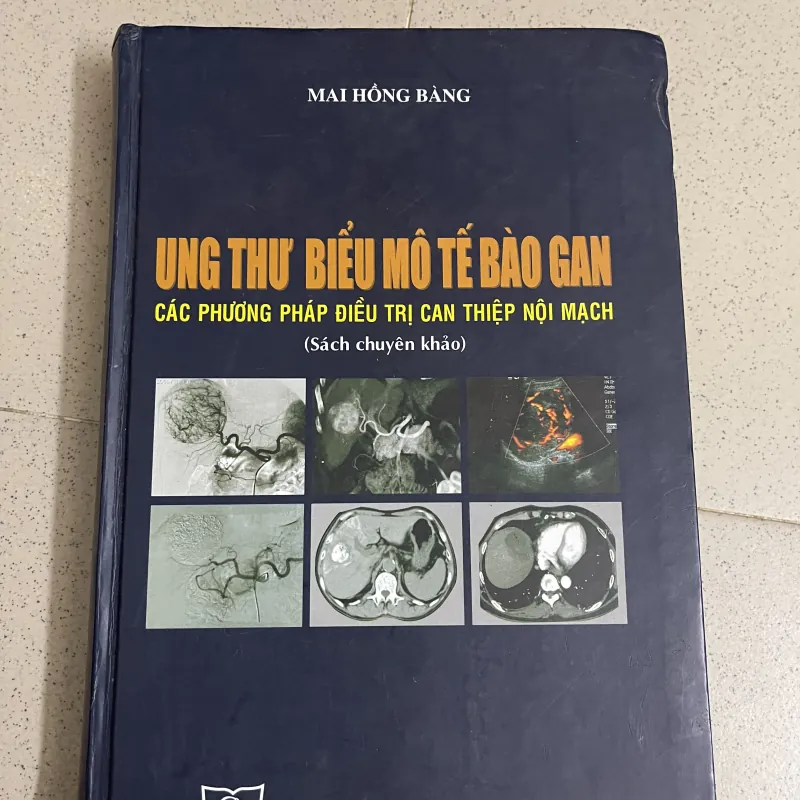 Ung thư biểu mô tế bào gan – Các phương pháp điều trị can thiệp nội mạch  763552