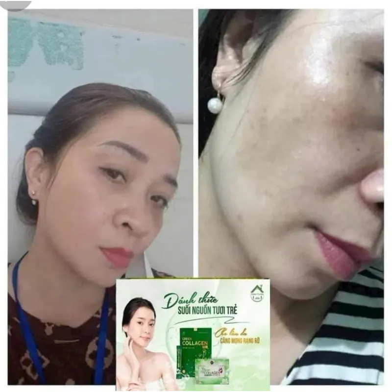 Diệp lục collagen đẹp da 971556