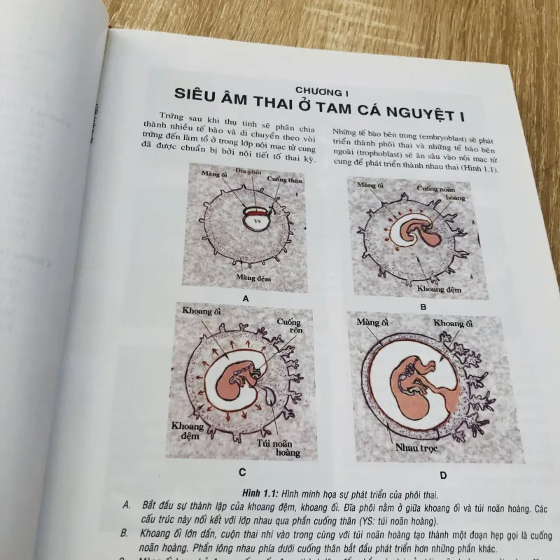 SIÊU ÂM SẢN KHOA THỰC HÀNH  974768