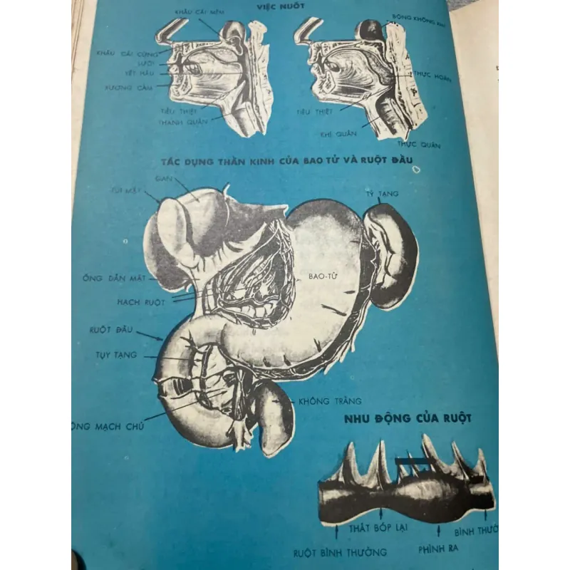 BỆNH SUYỄN - SÁCH Y KHOA TRƯỚC 75 572912