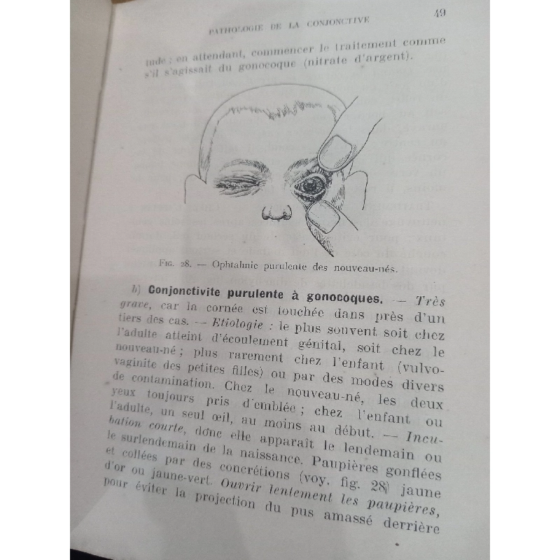 Ophtalmologie - A. Cantonnet 551398