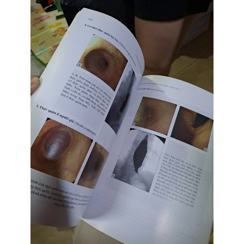 Tạp chí khoa học tiêu hóa việt nam Tập IX số 59 mới 90% 2020 HCM0808 TẠP CHÍ, THIẾT KẾ, THỜI TRANG 924849