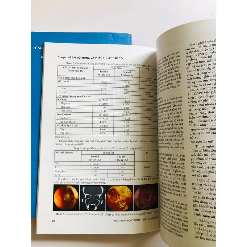 📚 2 TẬP CHUYÊN ĐỀ TAI - MŨI - HỌNG VÀ PHẪU THUẬT ĐẦU CỔ 601905