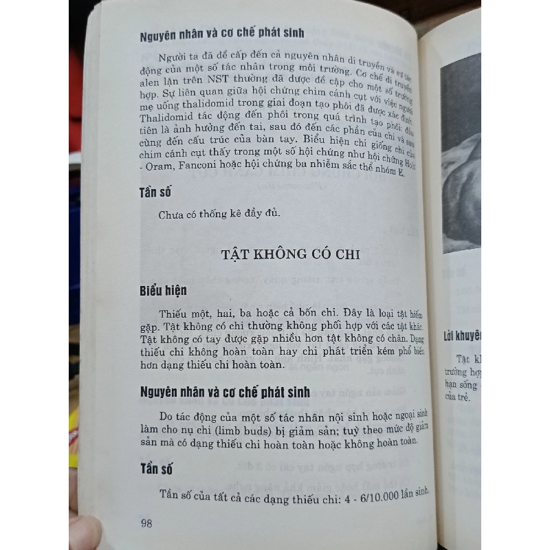 Dị dạng bẩm sinh - GS.TS. Trịnh Văn Bảo 799373