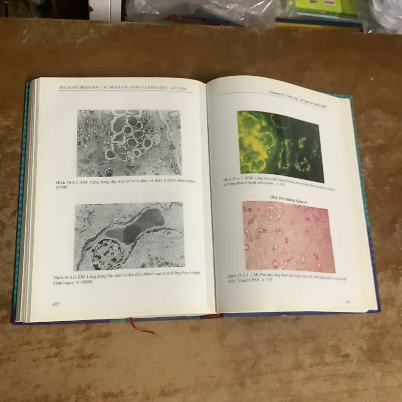 ATLAS MÔ BỆNH HỌC CÁC BỆNH CẦU THẬN & BỆNH ỐNG - KẼ THẬN 935201