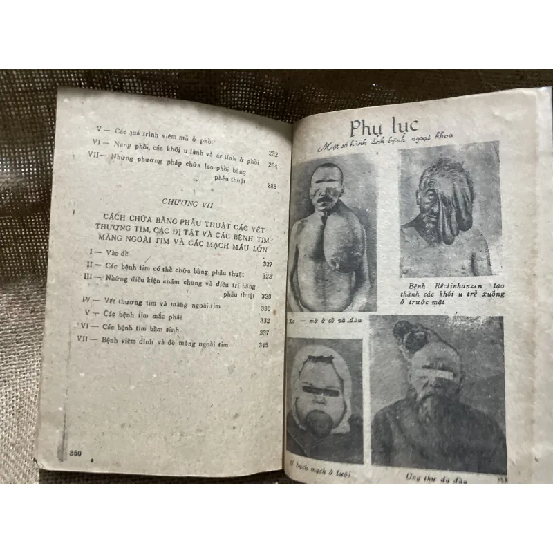 Bệnh ngoại khoa Tập 1 - 360 trang  855620
