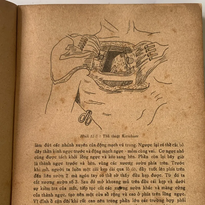 Bài giảng Điều trị học ngoại khoa, Trương Công Trung - Nguyễn Đình Hối 710862