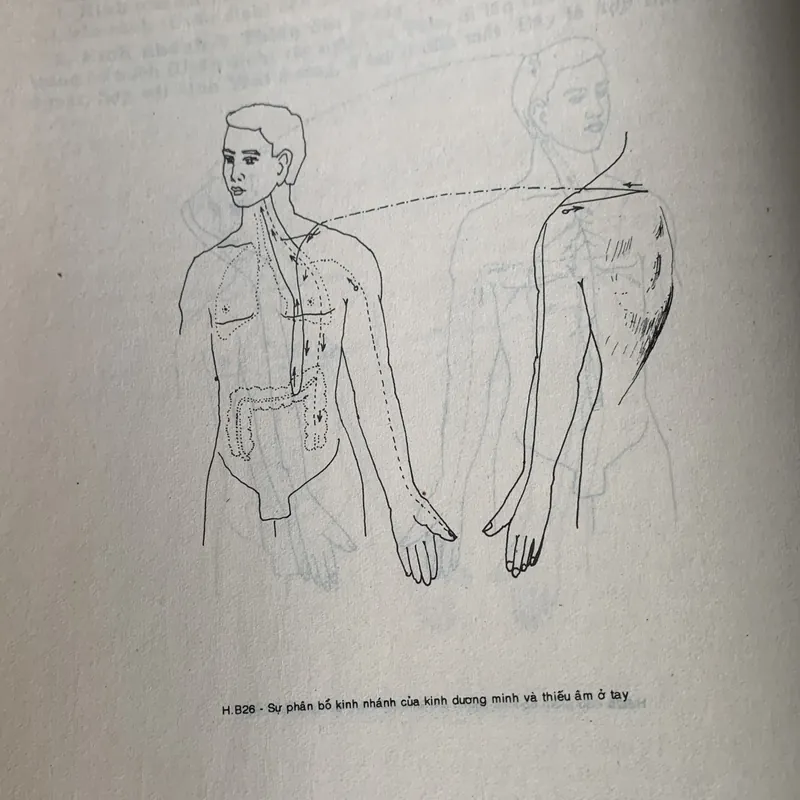 Châm cứu học, nhiều hình ảnh minh hoạ 608337