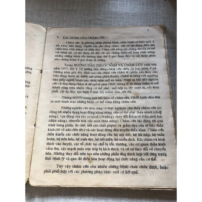 Châm cứu học  992376