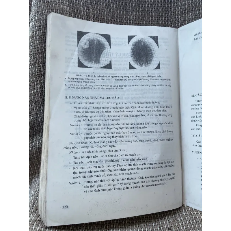 Bảo giảng chấn đoán hình ảnh; sách y, hơn 300 trang khổ lớn  1025089