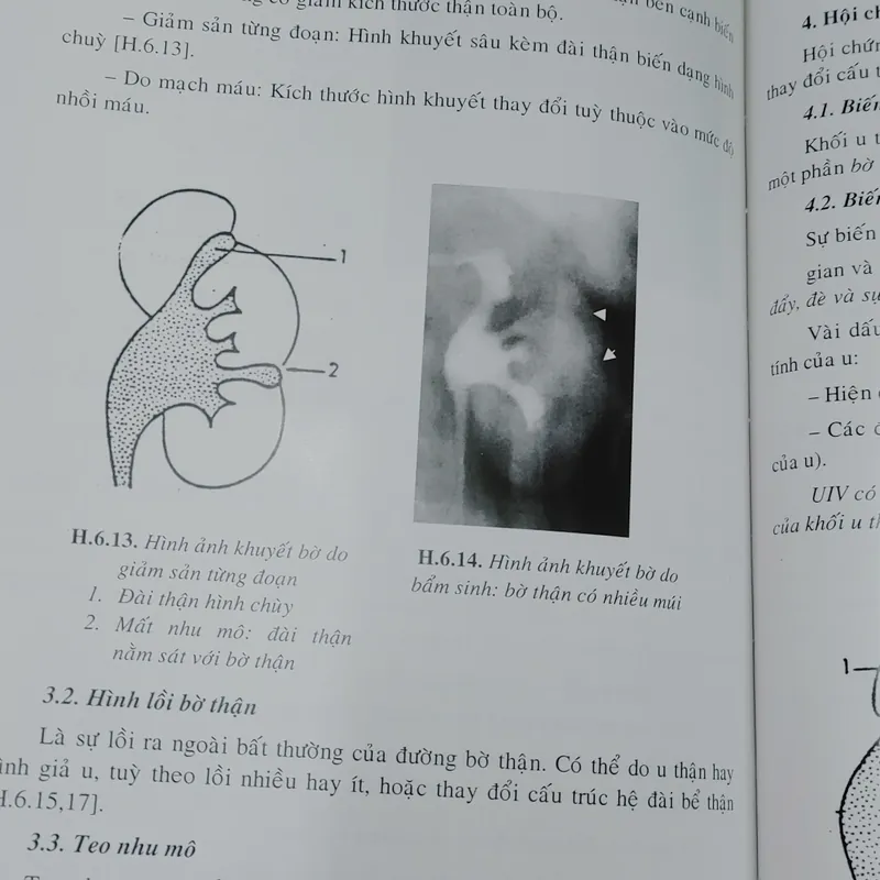 CHẨN ĐOÁN X QUANG  572267