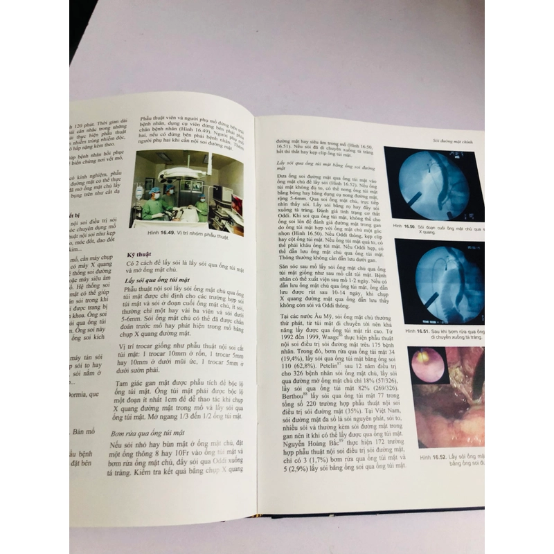 📚 SỎI ĐƯỜNG MẬT – Nguyễn Đình Hối, Nguyễn Mậu Anh 539457