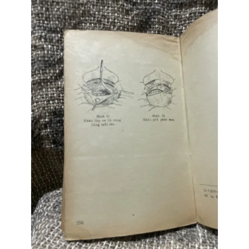 Cấp cứu sản khoa -230 trang  1010002