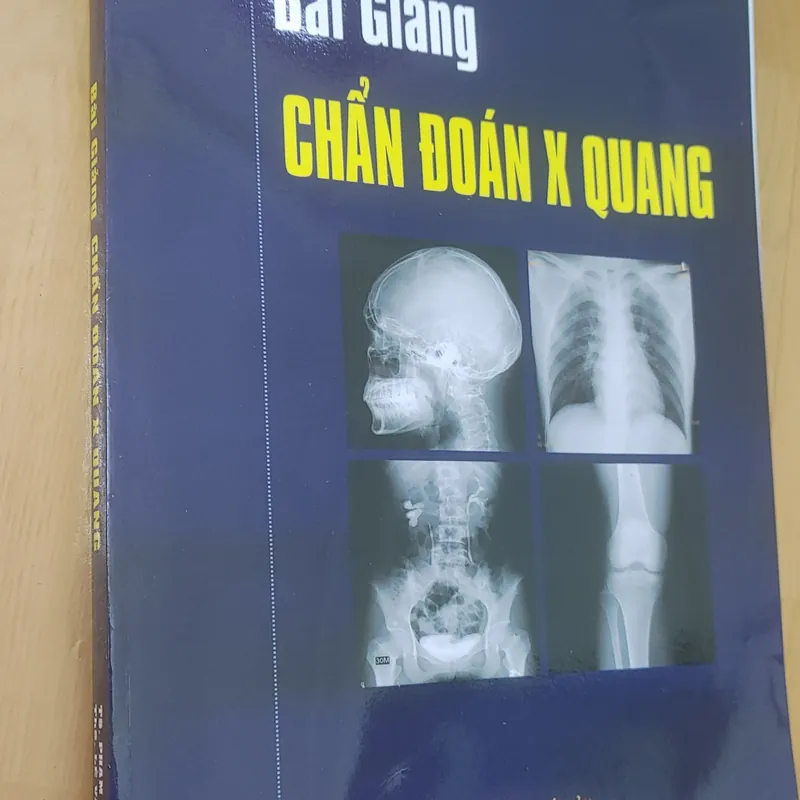 CHẨN ĐOÁN X QUANG  572267