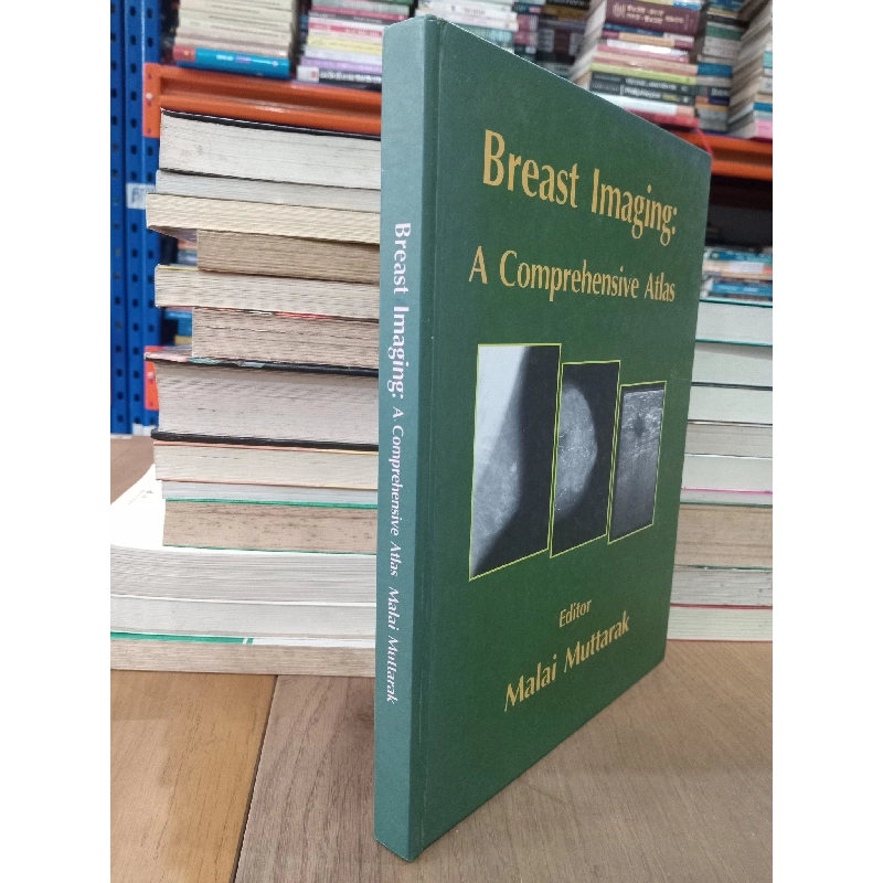 Breast Imaging: A Comprehensive Atlas - Malai Muttarak 703644