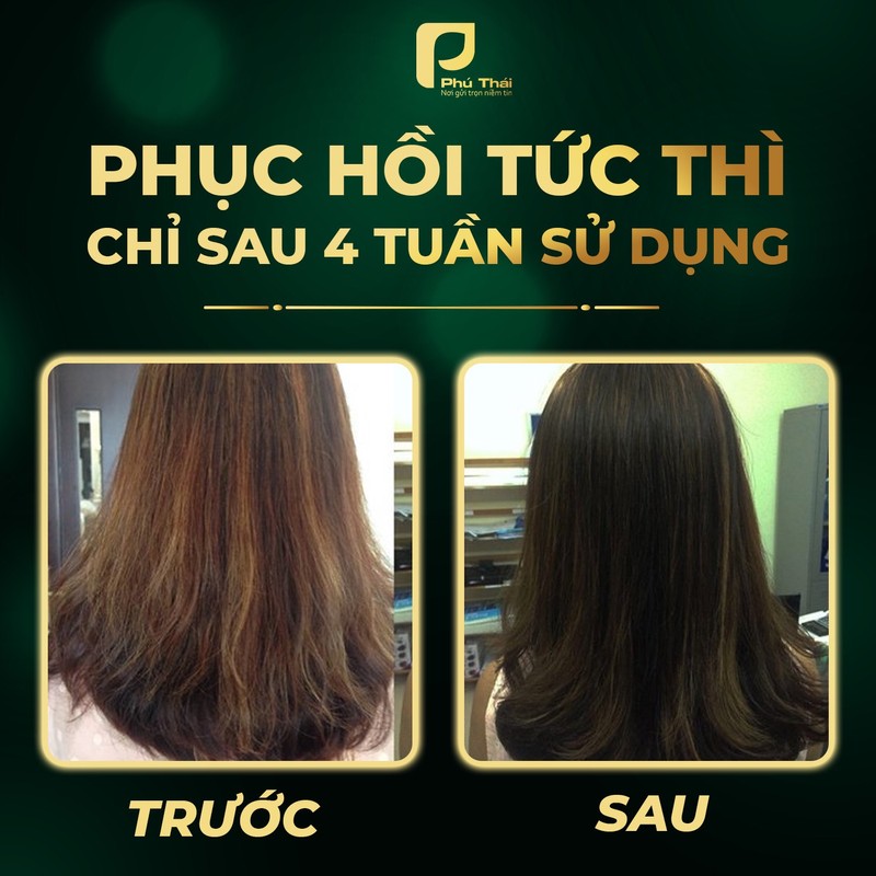 [CHĂM SÓC TÓC CHUYÊN SÂU – PHỤC HỒI HƯ TỔN] Dầu xả Cannabis Hair 74960