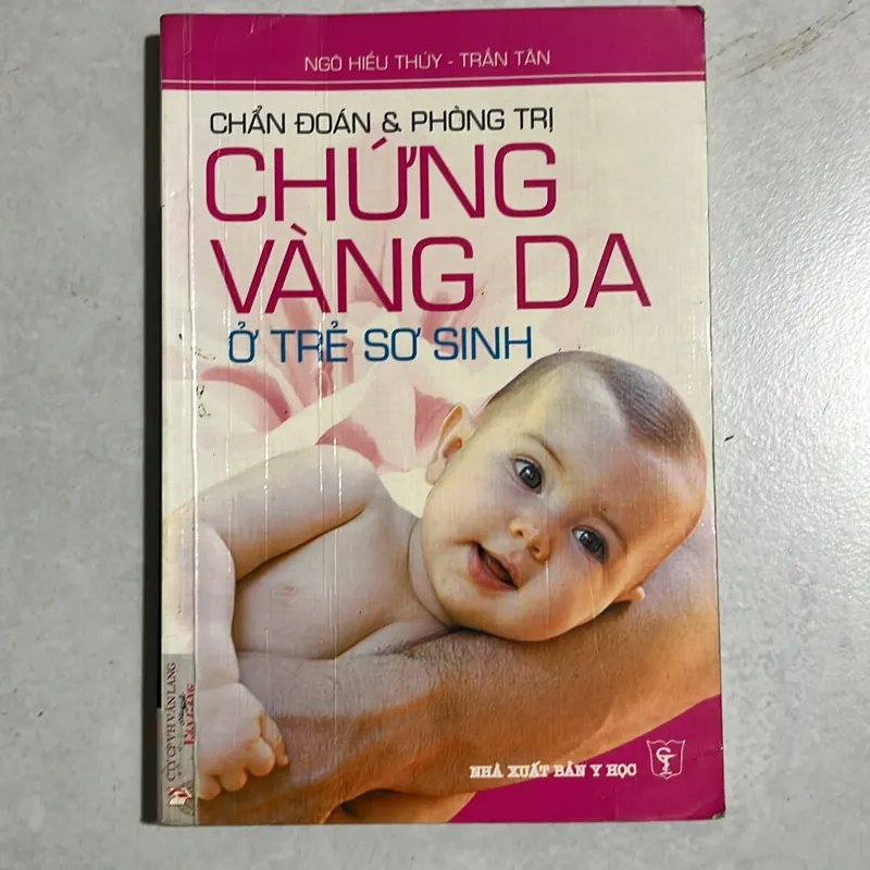 Chẩn đoán & phòng trị chứng vàng da ở trẻ sơ sinh 589623