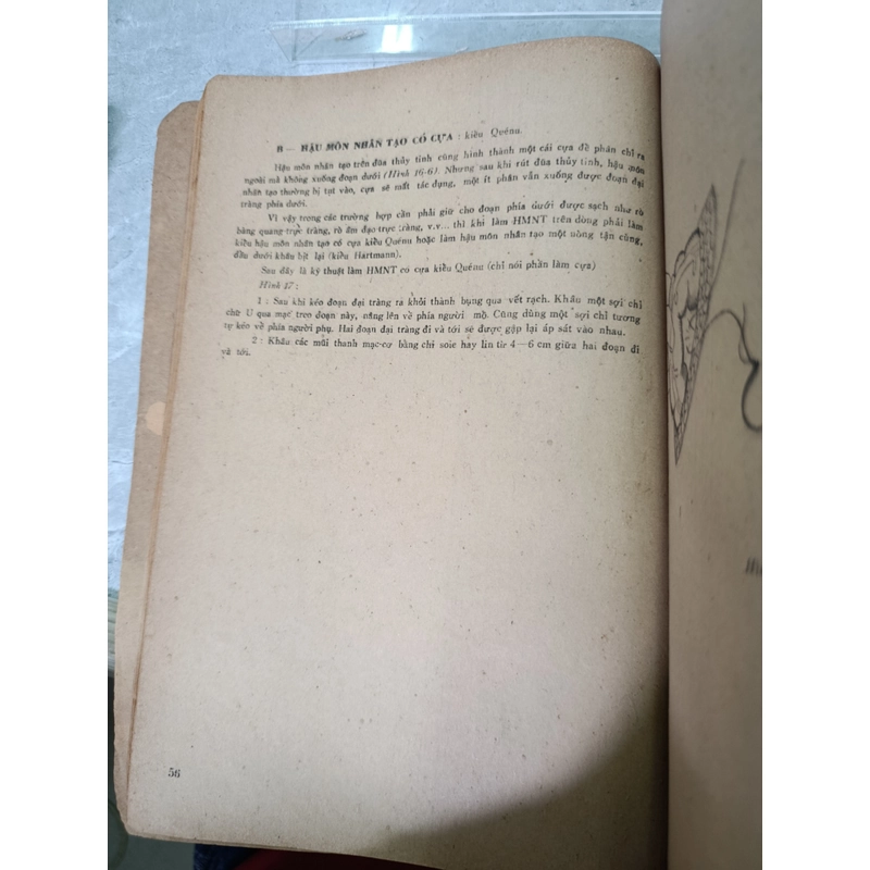 PHẪU THUẬT NGOẠI KHOA THƯỜNG DÙNG (BẰNG HÌNH VẼ) - BS.NGUYỄN ĐĂNG TRINH 542378