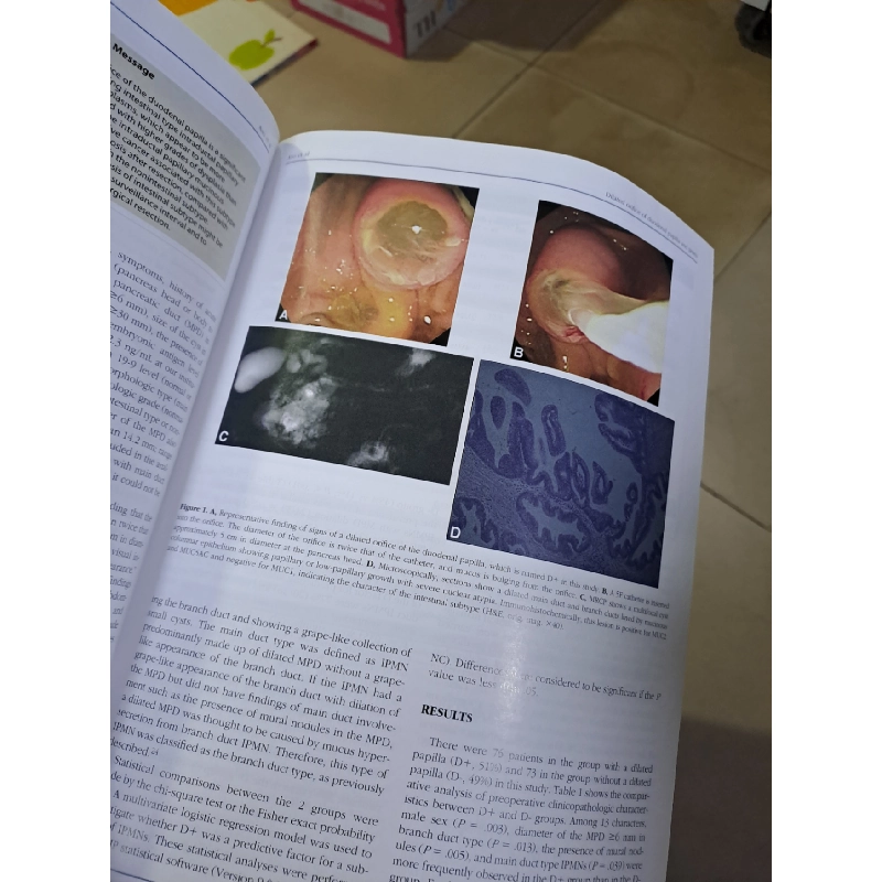 GIE Gastrointestinal Endoscopy volume 76 no 2 8/2012 HCM0808 TẠP CHÍ, THIẾT KẾ, THỜI TRANG 527154