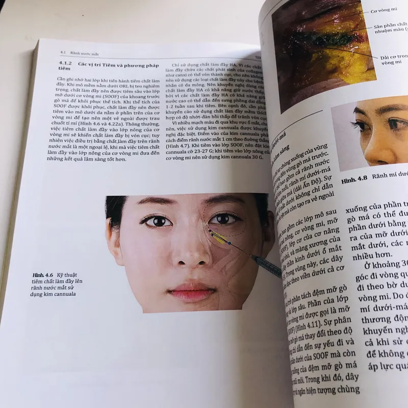 TIÊM BOTULINUM TOXIN VÀ CHẤT LÀM ĐẦY 568271