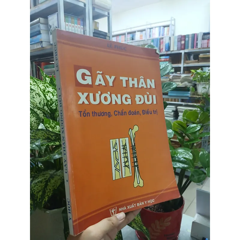 GÃY THÂN XƯƠNG ĐÙI - TỔN THƯƠNG, CHẨN ĐOÁN, ĐIỀU TRỊ 595415