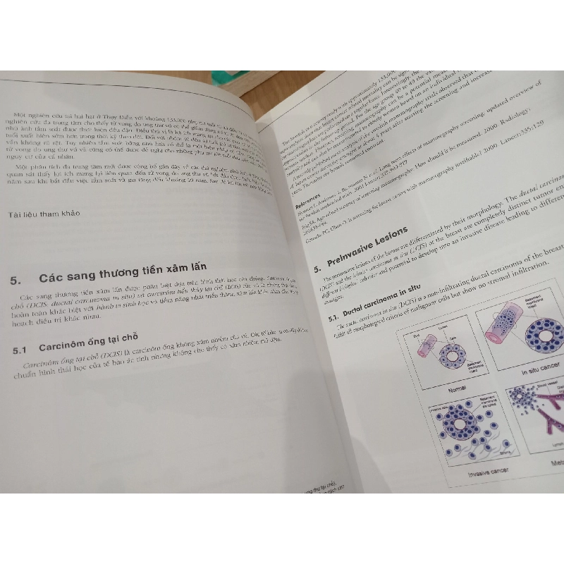 Module 11: Breast Cancer - E. Stickeler, D. Watermann 703649