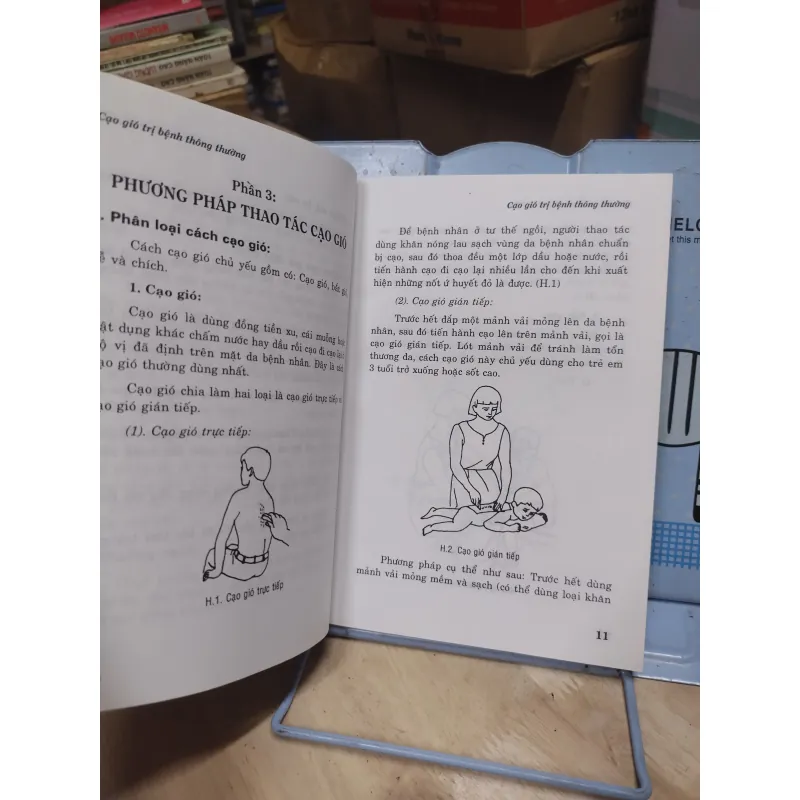 Sách: Cạo gió trị bệnh thông thường - TG: Công Sĩ (A2) 934880