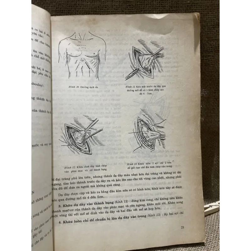 Phẫu thuật ống tiêu hóa GS.PTS. NGUYỄN ĐỨC NINH- 200 trang khổ lớn  799810