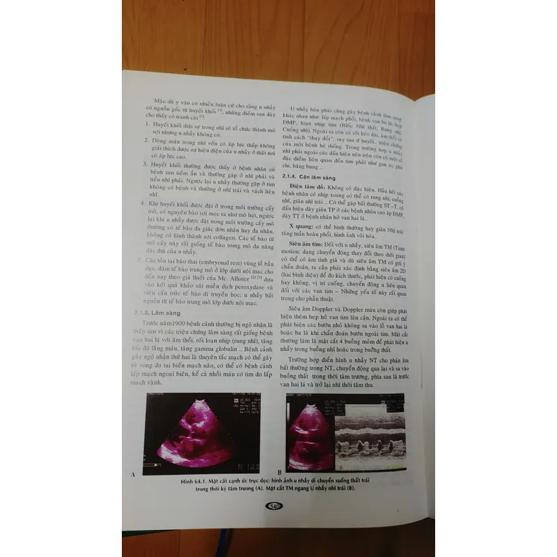 BỆNH HỌC TIM MẠCH  593432