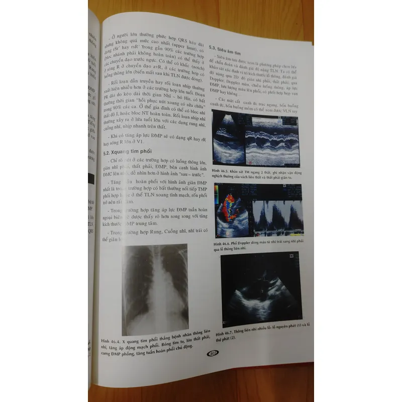 BỆNH HỌC TIM MẠCH  593432
