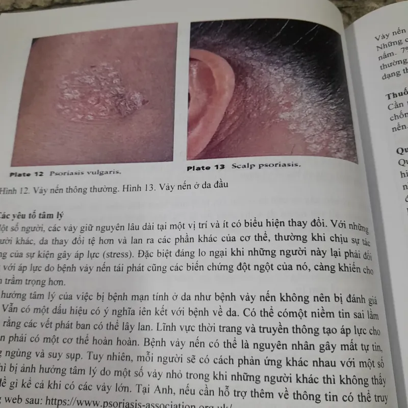 Các triệu chứng ở nhà thuốc. Hướng dẫn xử lý. Ấn bản tiếng Việt. Alison Blenkknsopp 602657