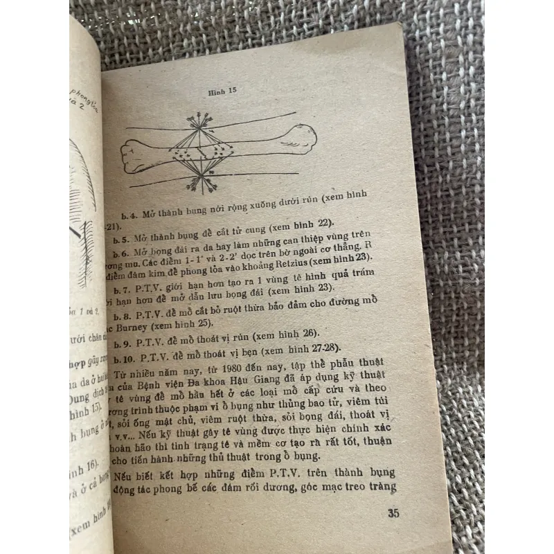 Phương pháp gây tê - GS Trương Công Trung  1025097