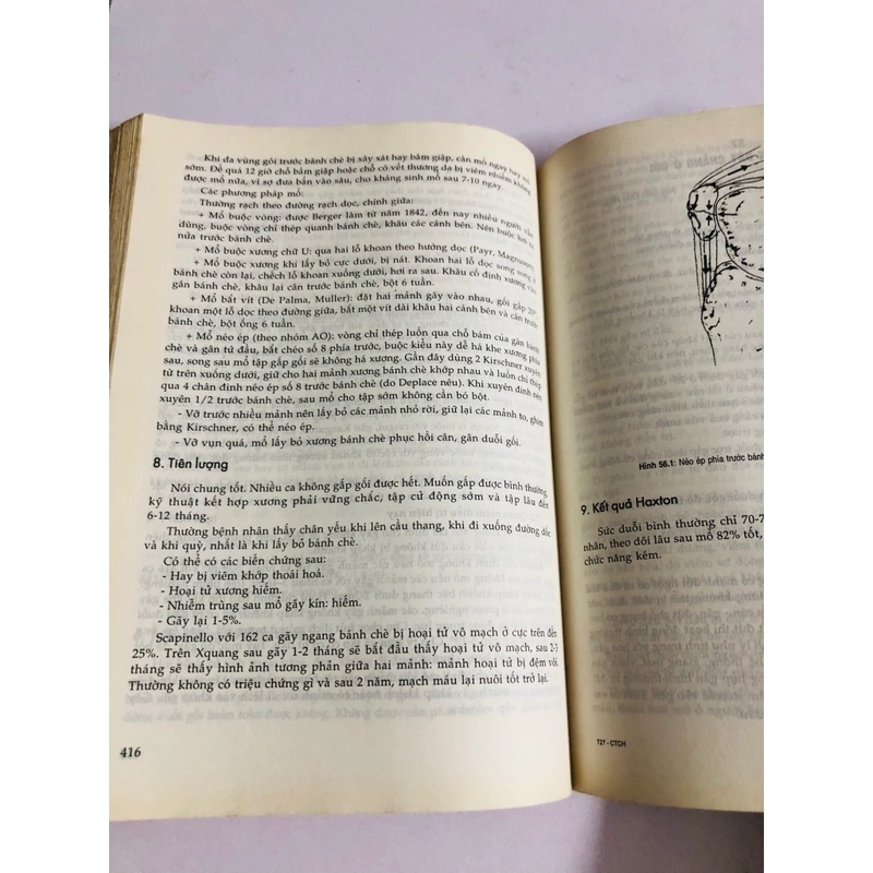 CHẤN THƯƠNG CHỈNH HÌNH  539411