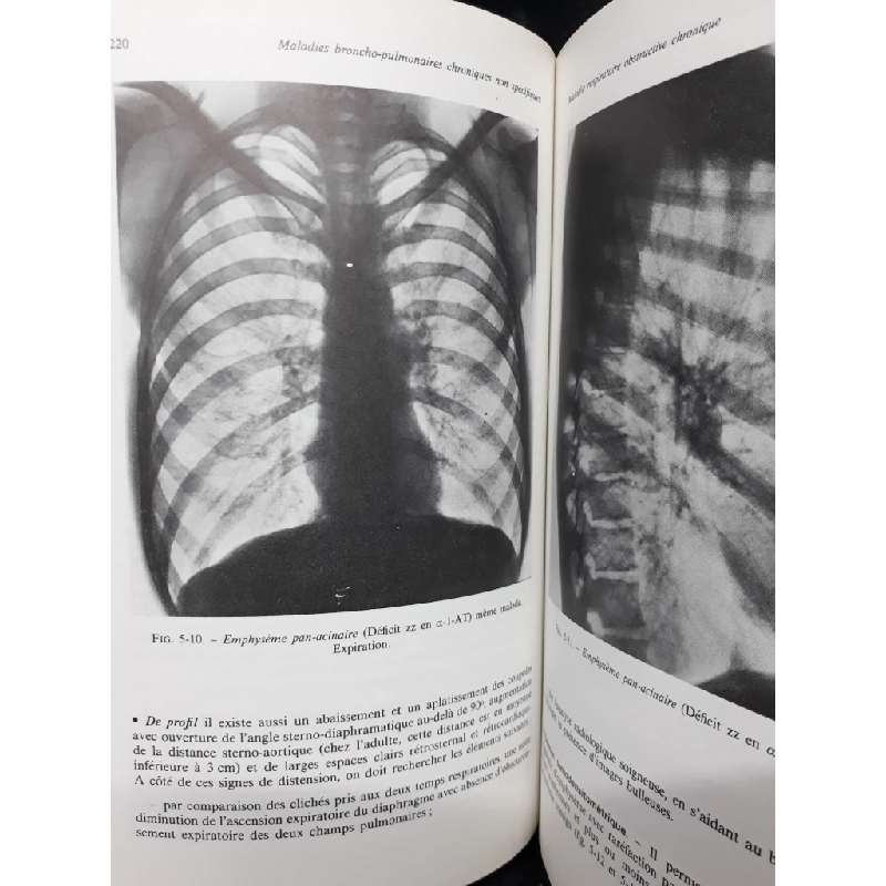 Pneumologie mới 80% bẩn bìa, ố vàng HCM1410 J.Chretien - J.Marsac HỌC NGOẠI NGỮ 301439