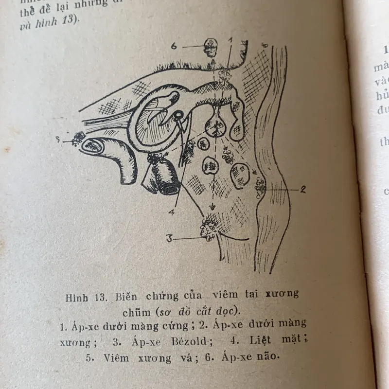 Cấp cứu tai mũi họng, Lê Văn Bích và Ngô Mạnh Sơn 709423