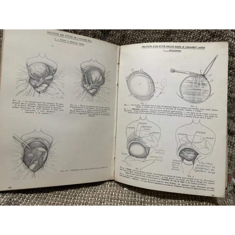 Kthuật phẫu thuật bằng hình ảnh -TECHNIQUE CHIRURGIEALE EN FIGURES G.JEANNENEY& J.MAGENDIE 1006345