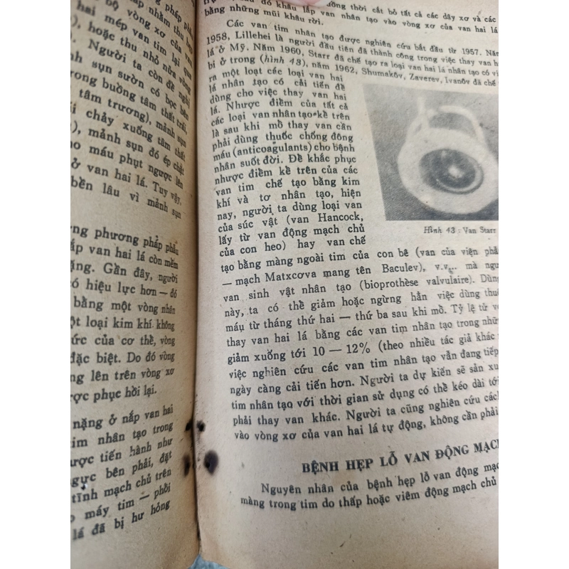 PHẪU THUẬT CÁC BỆNH TIM 546192