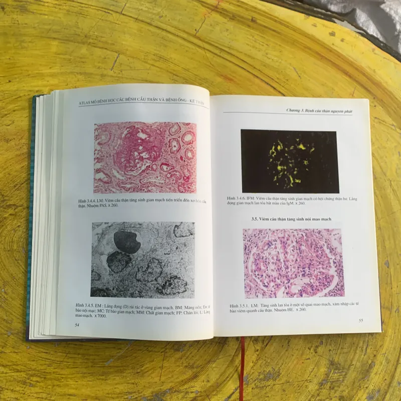 ATLAS MÔ BỆNH HỌC CÁC BỆNH CẦU THẬN & BỆNH ỐNG - KẼ THẬN 1009009