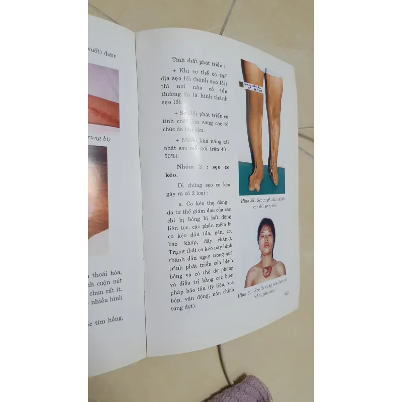 BỎNG NHỮNG KIẾN THỨC CHUYÊN NGÀNH  1010542