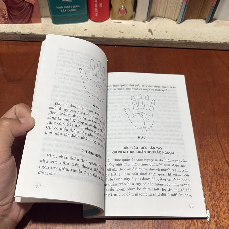 Nhìn Tay Biết Bệnh: Bí Quyết Chẩn Đoán Khí Sắc Hình Của  Bàn Tay -Phạm Viết Dự, Thái Nhiên 786804