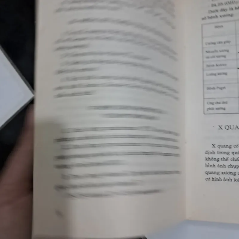 Bệnh thấp khớp 995572