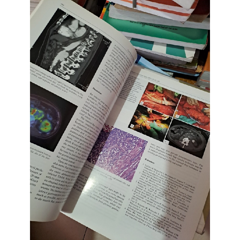 General Thoracic and Cardiovascular Surgery Volume 59 Number 7 2011 HCM0808 TẠP CHÍ, THIẾT KẾ, THỜI TRANG 527262