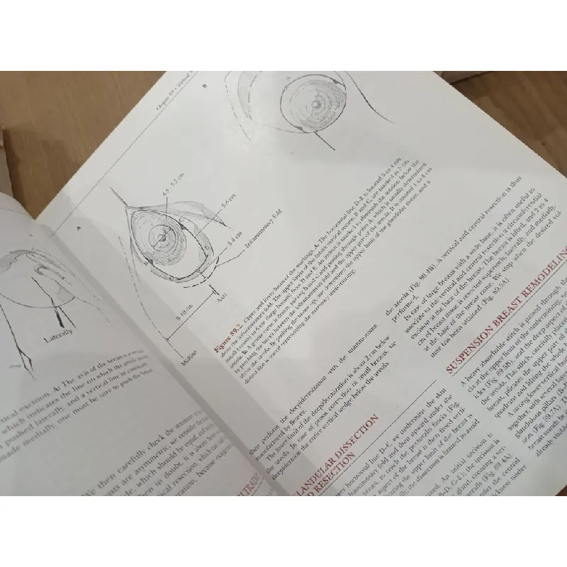 Surgery of the breast 703637