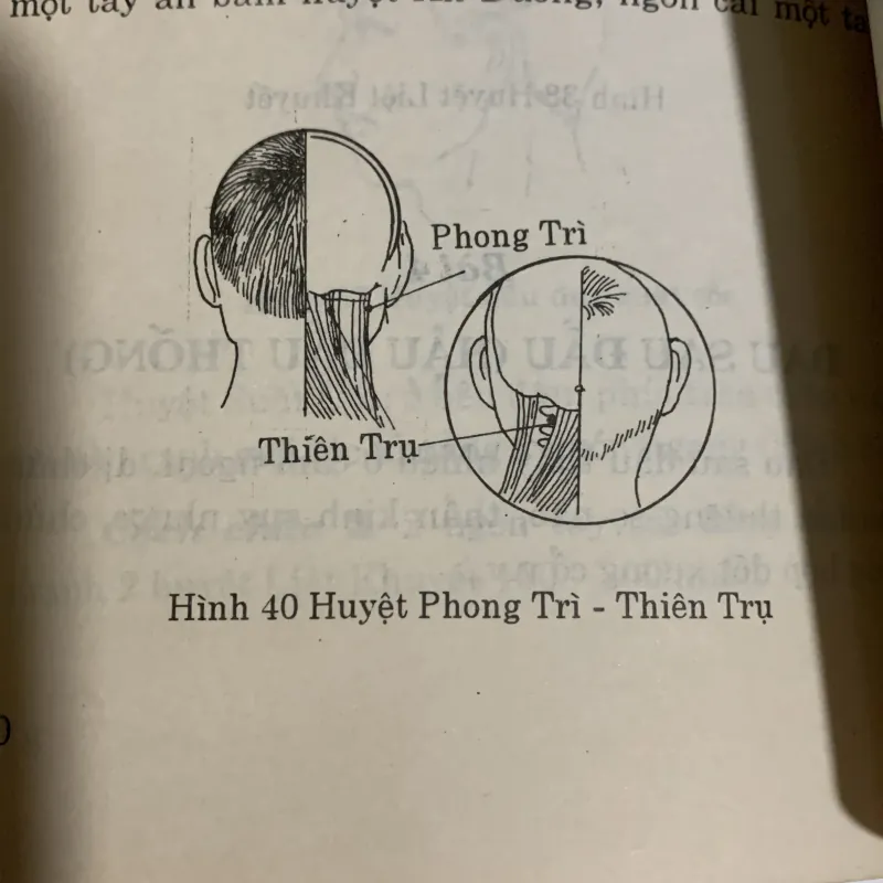 Liệu pháp bấm huyệt, NXB Y học, in năm 1998 936930