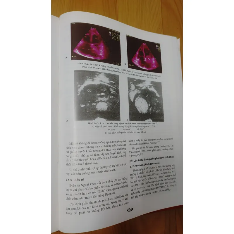 BỆNH HỌC TIM MẠCH  593432