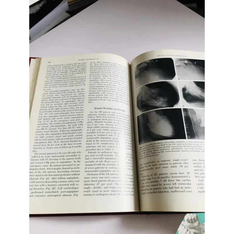 CARDIOLOGY CLINICS – Coronary angioplasty - BÌA CỨNG, KHỔ TO 698172